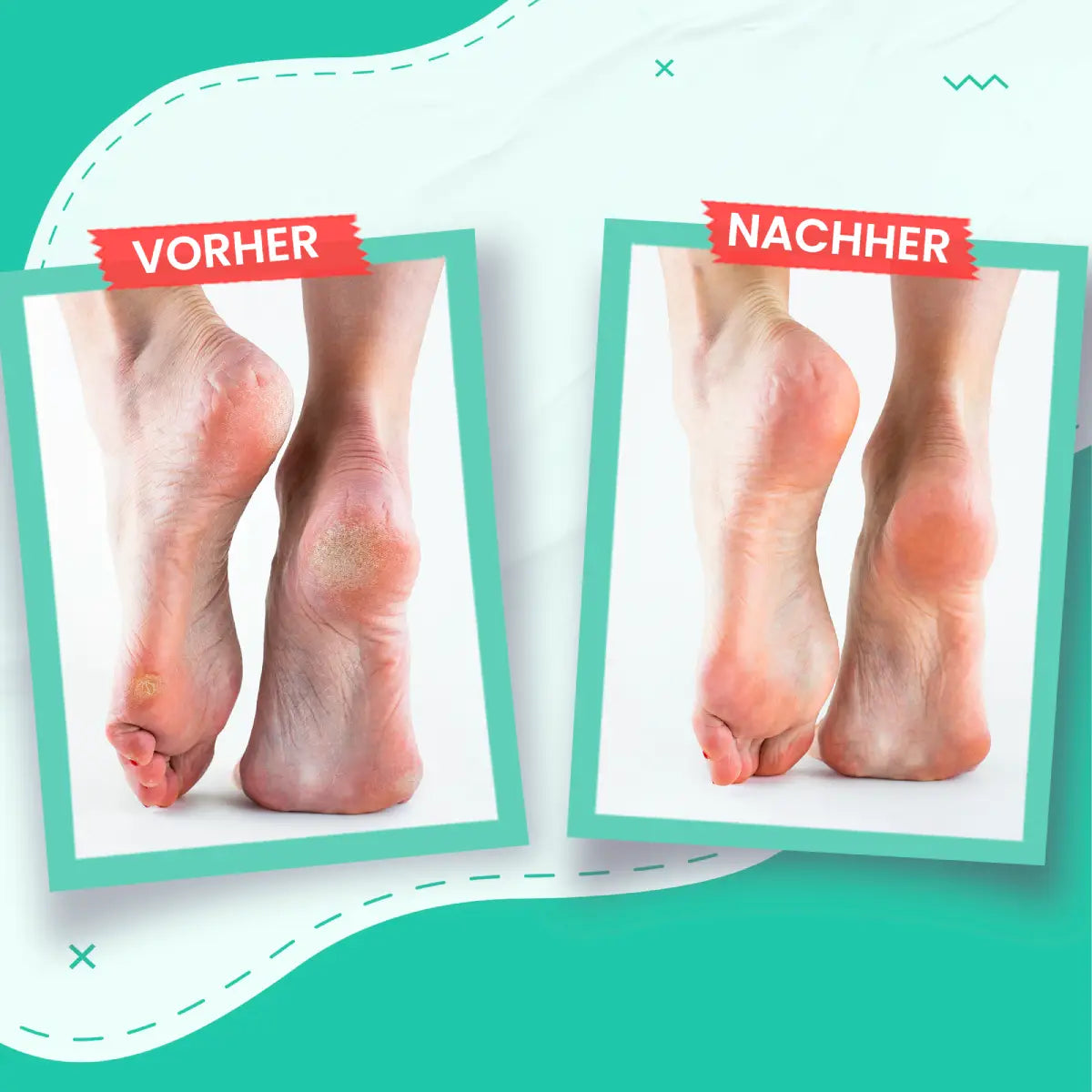 Fußcreme Für Trockene & Rissige Haut